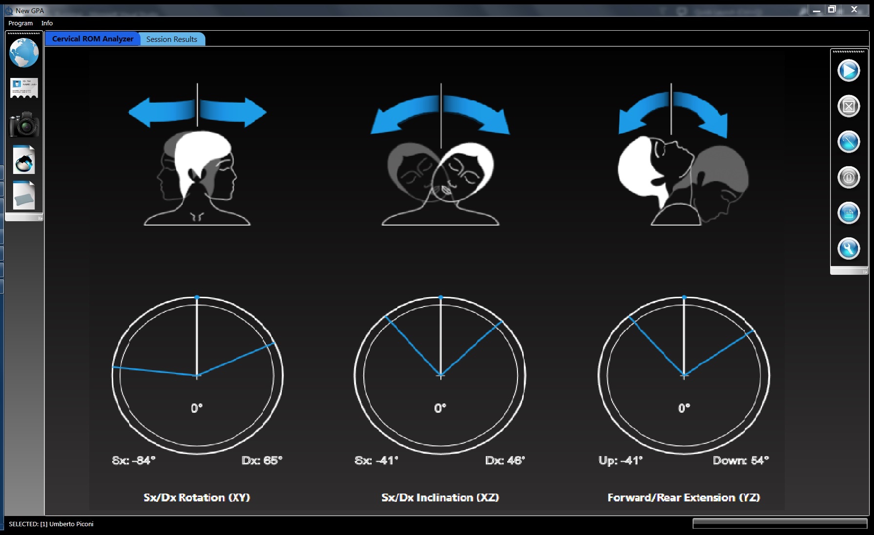 Cervical ROM